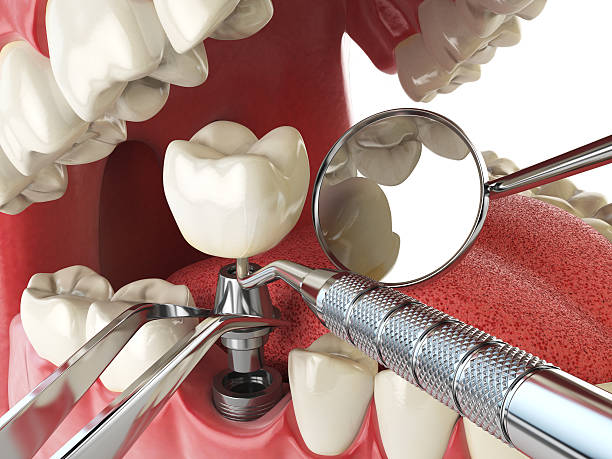 Best Cracked Tooth Emergency Dentist  in Zion, PA